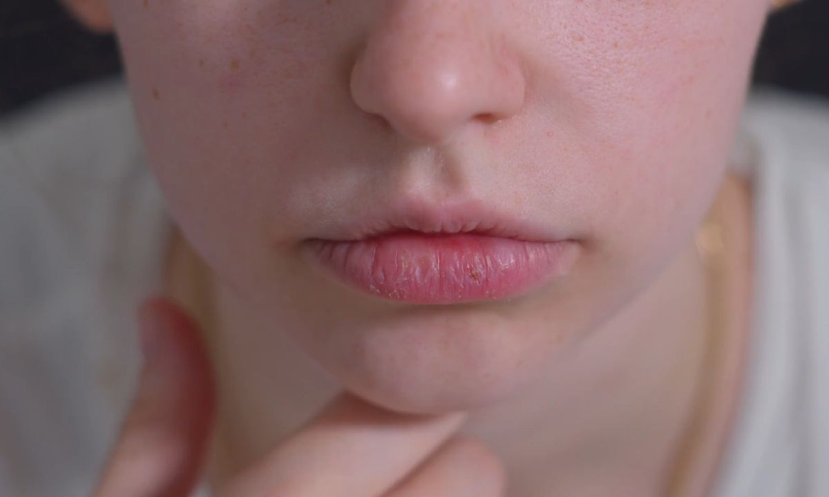 prikaz ženskih ispucalih usana